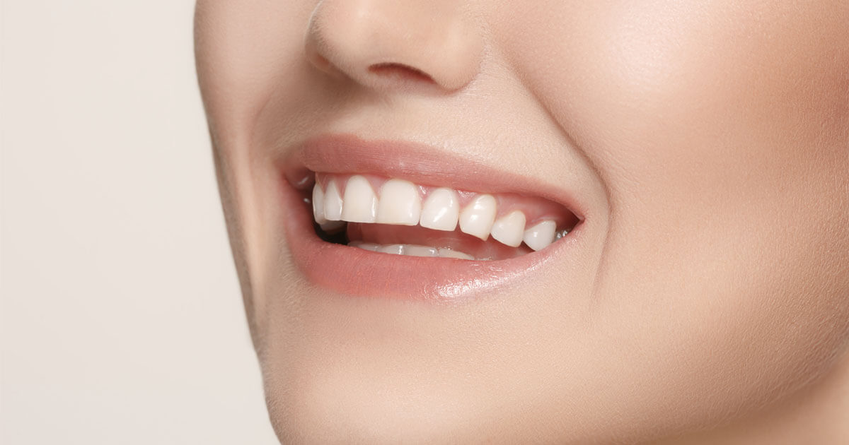 Dental Crowns & Bridges | Cherry Creek Dental Spa, Denver CO