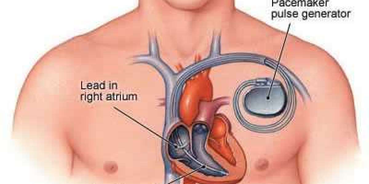 Cardiac Pacemaker Market New Business Strategies And Forecast By 2027