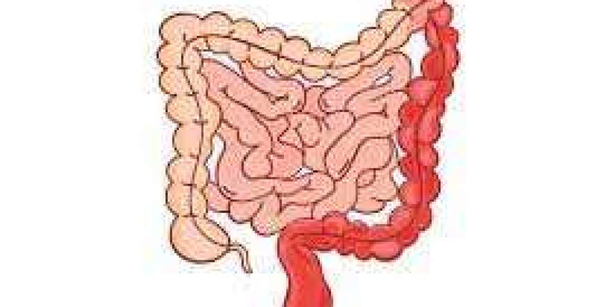 Ulcerative Colitis Market Outlook, Key Players, Share, Size, Overview, Growth, and Forecast 2019 to 2027