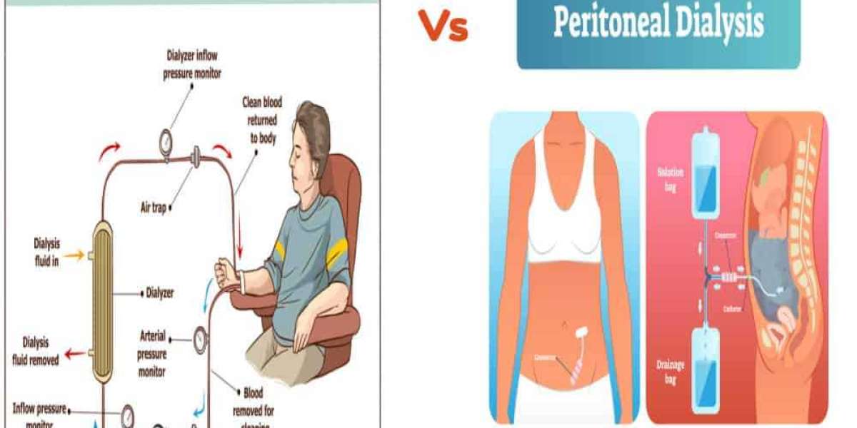 Hemodialysis and Peritoneal Dialysis Market Size, Growth Challenges, and Future Developments to 2035