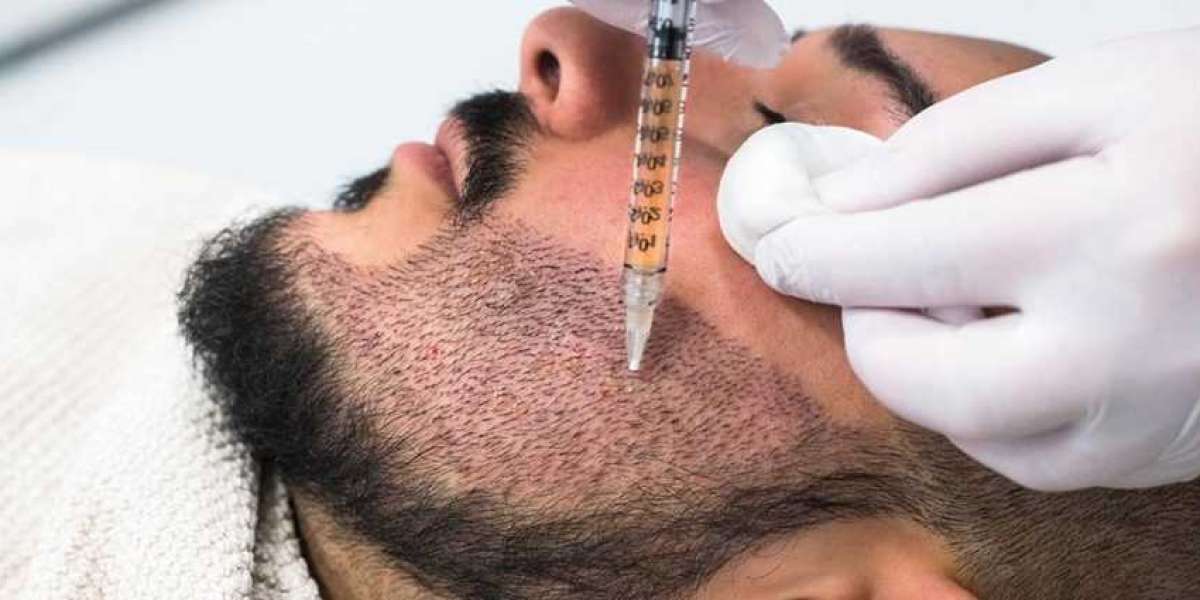 Beard Transplant In Palm Desert