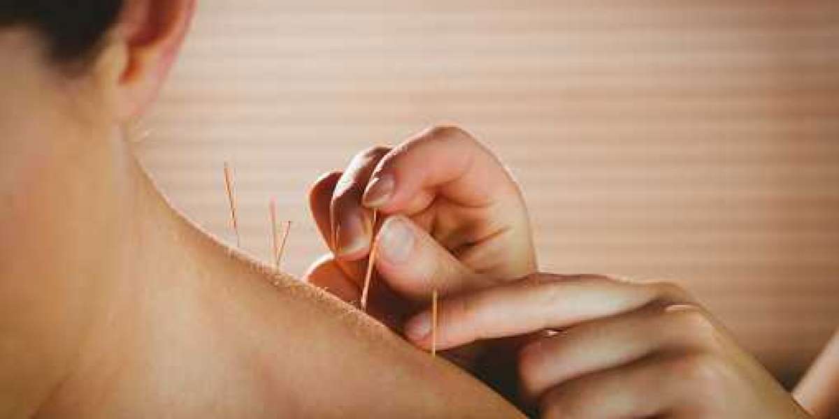 Acupuncture for Neck Pain in Morristown