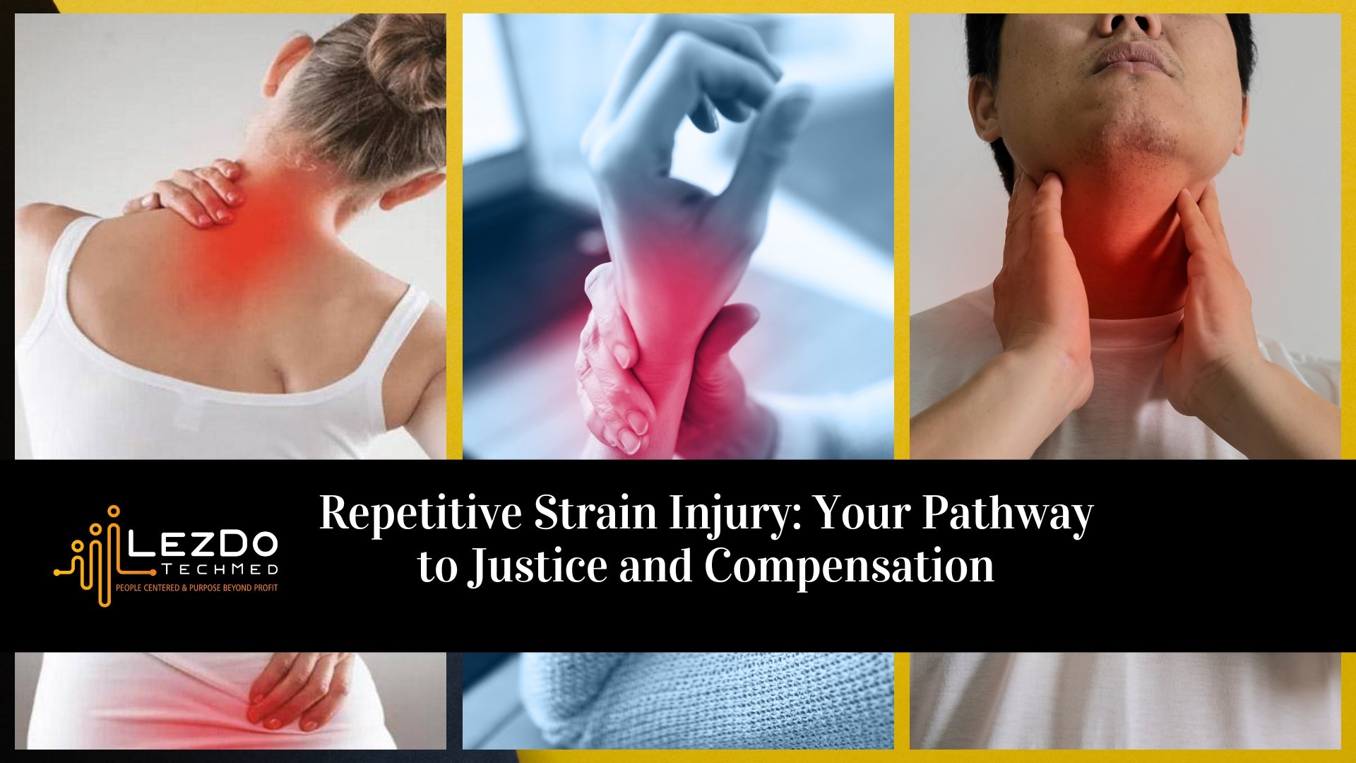 Repetitive Strain Injury: Your Pathway to Justice and Compensation