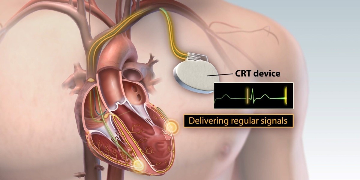 Global Cardiac Resynchronization Therapy (CRT) Market Research on Flourishing Industry Growth; Asserts MRFR