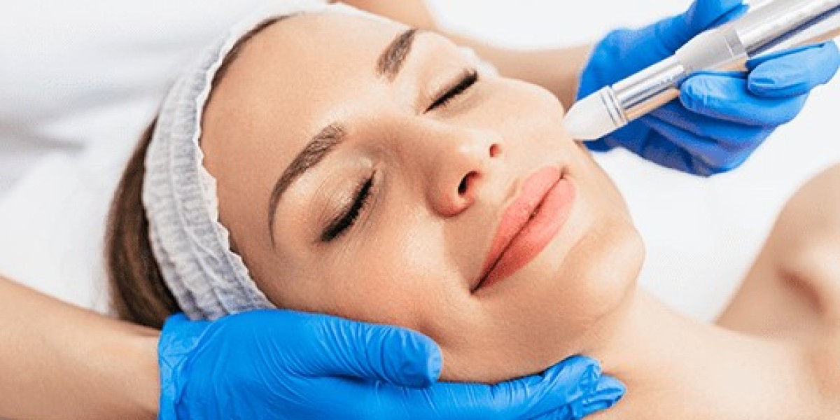 Microneedling Oakville: The Revolutionary Skin Rejuvenation Treatment