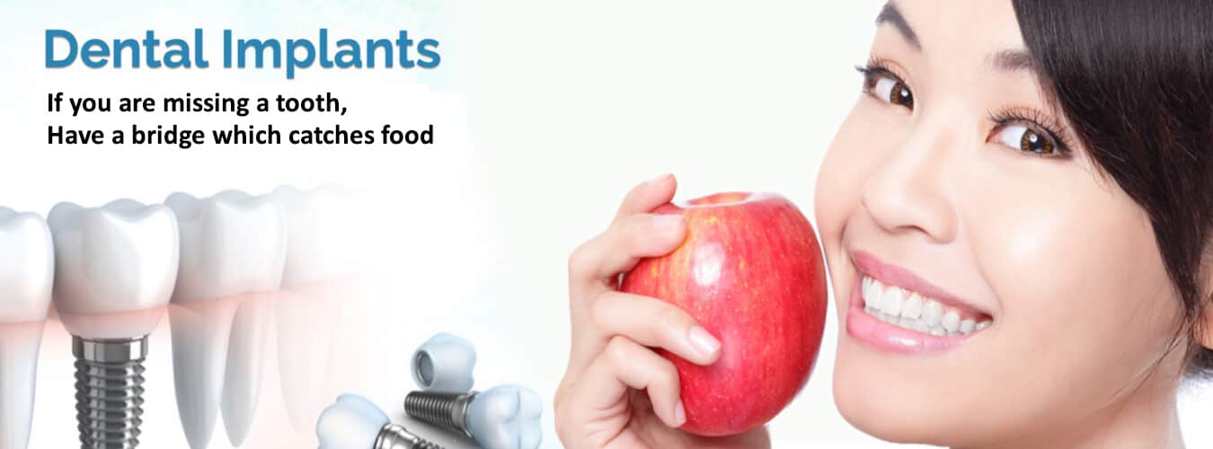 Best Dental Clinic in Jalandhar - Nuface Dental Implant Center