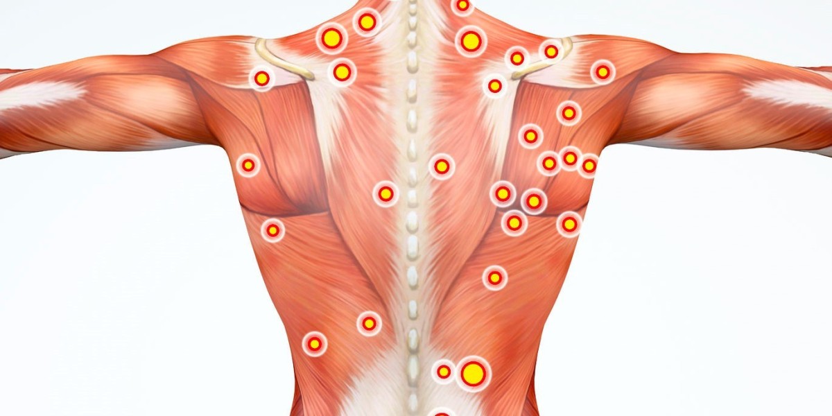 Myofascial Pain Syndromes Market Share, Epidemiology, Analysis & Trends 2023-2033