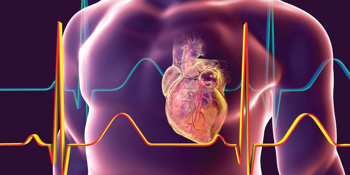 Understanding Cardiomyopathy: Market Analysis and Clinical Data