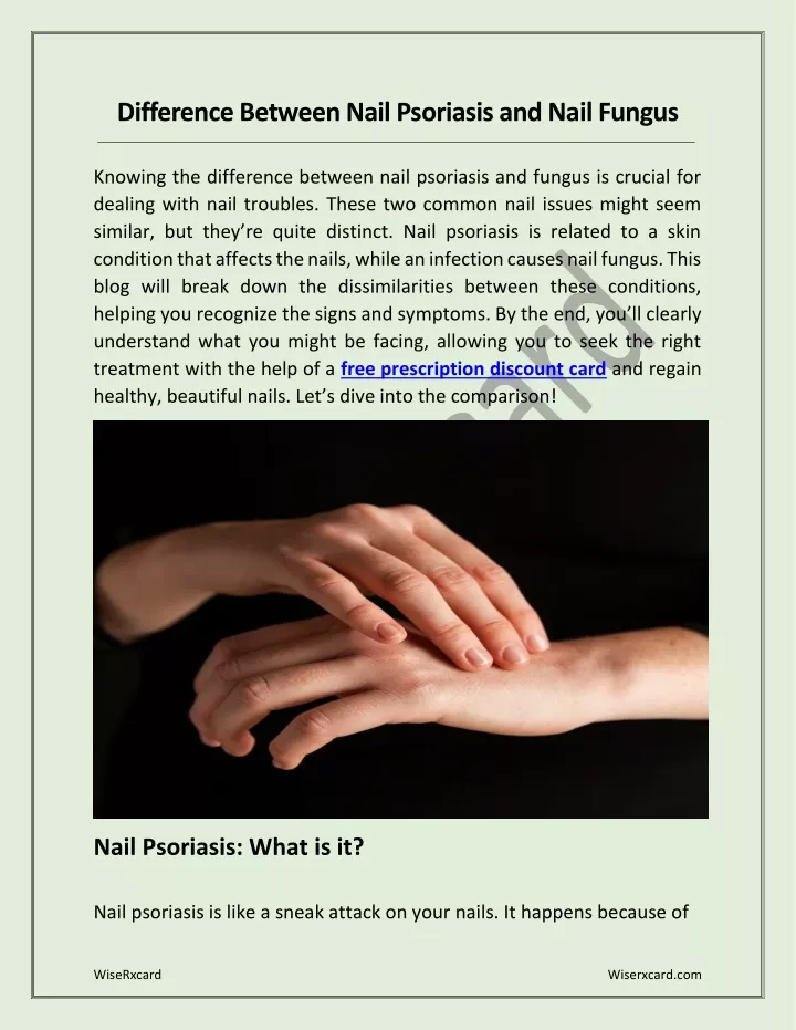PPT - Difference Between Nail Psoriasis and Nail Fungus PowerPoint Presentation - ID:12548845