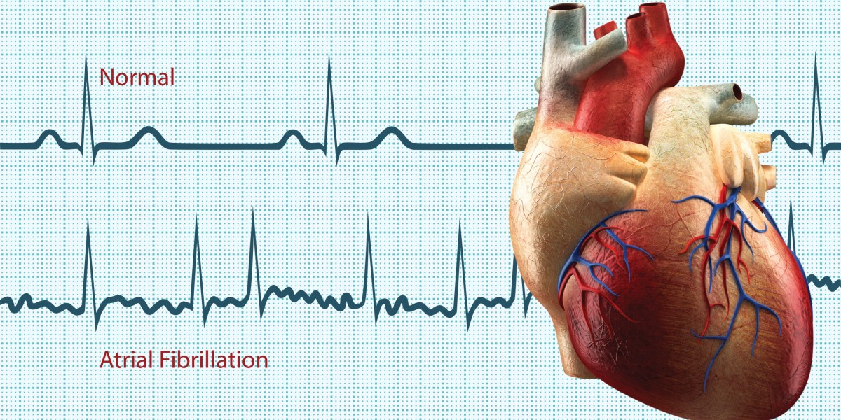 Pediatric Arrhythmia: Essential Information for Parents