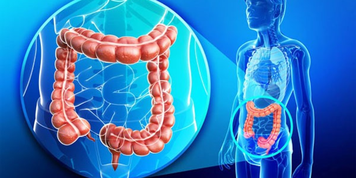 Colorectal Surgeon in Delhi