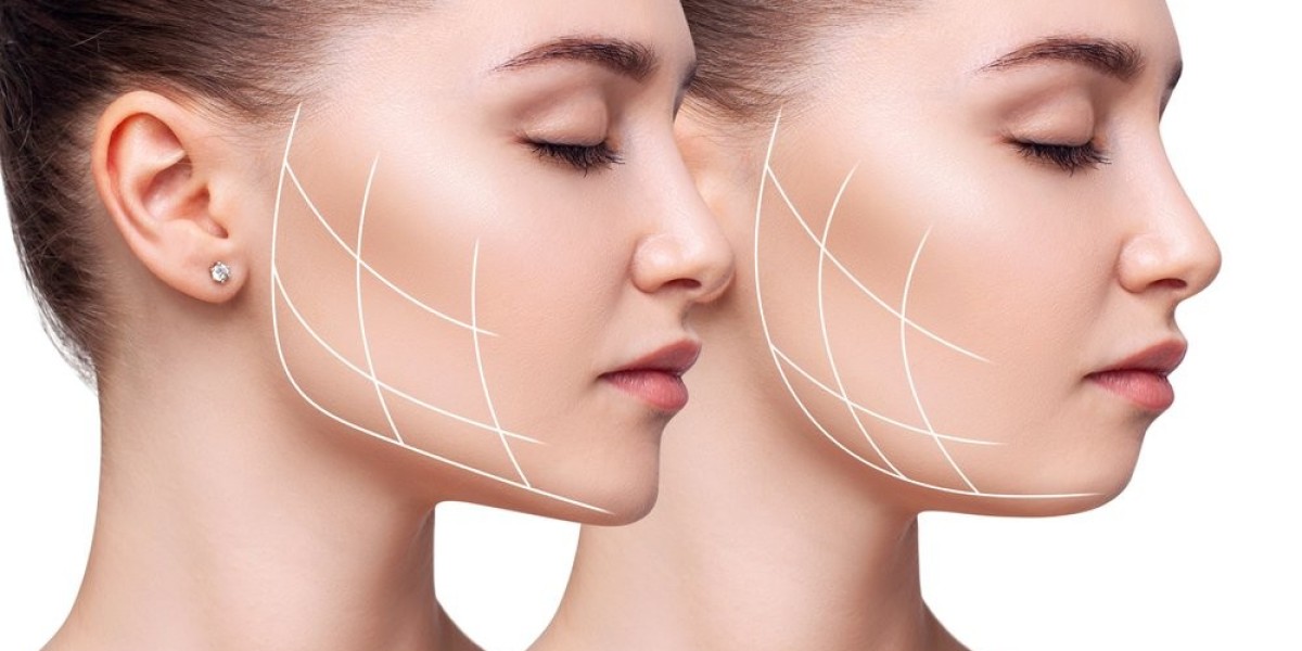 Exploring the Wonders of Radio Frequency Skin Tightening