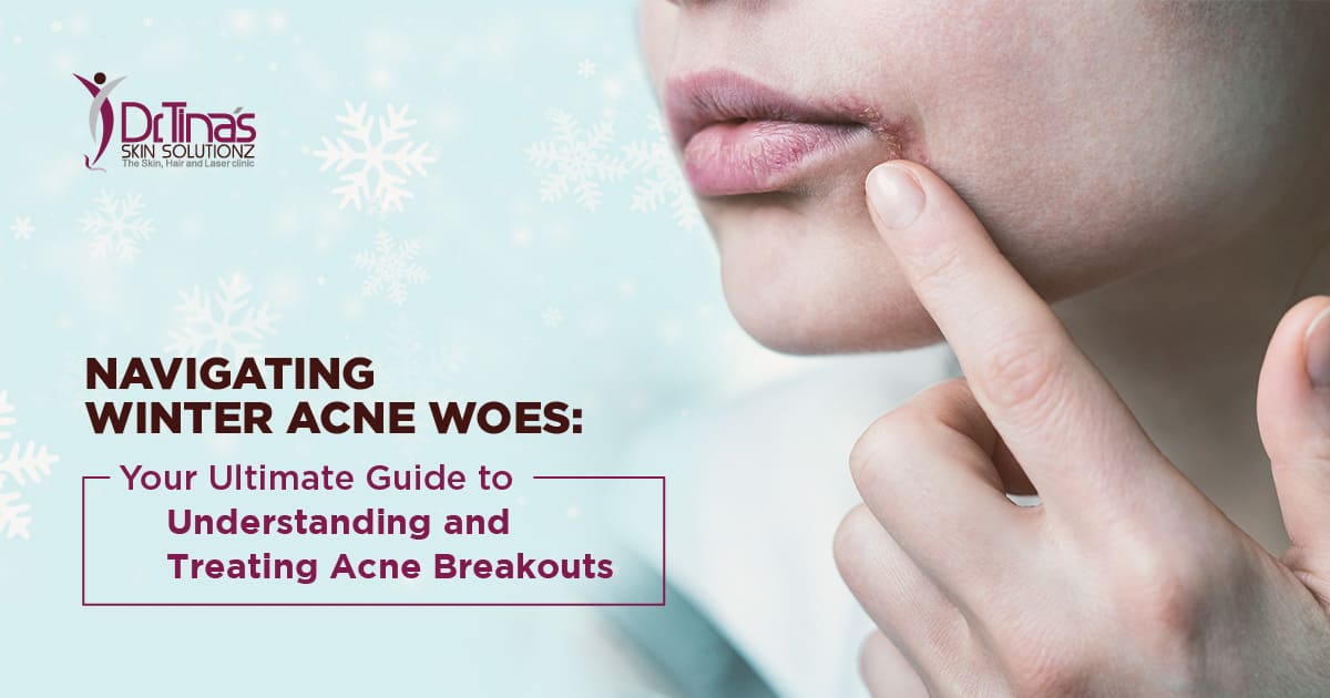 Why Do You Get Acne in Winter? The Ultimate Guide for Winter Acne Breakouts - Skin Solutionz