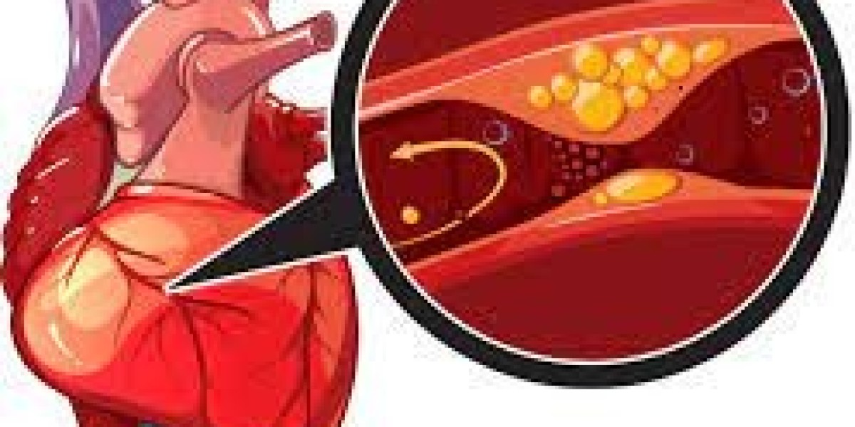 2023 Coronary Heart Disease Market | Report By 2033