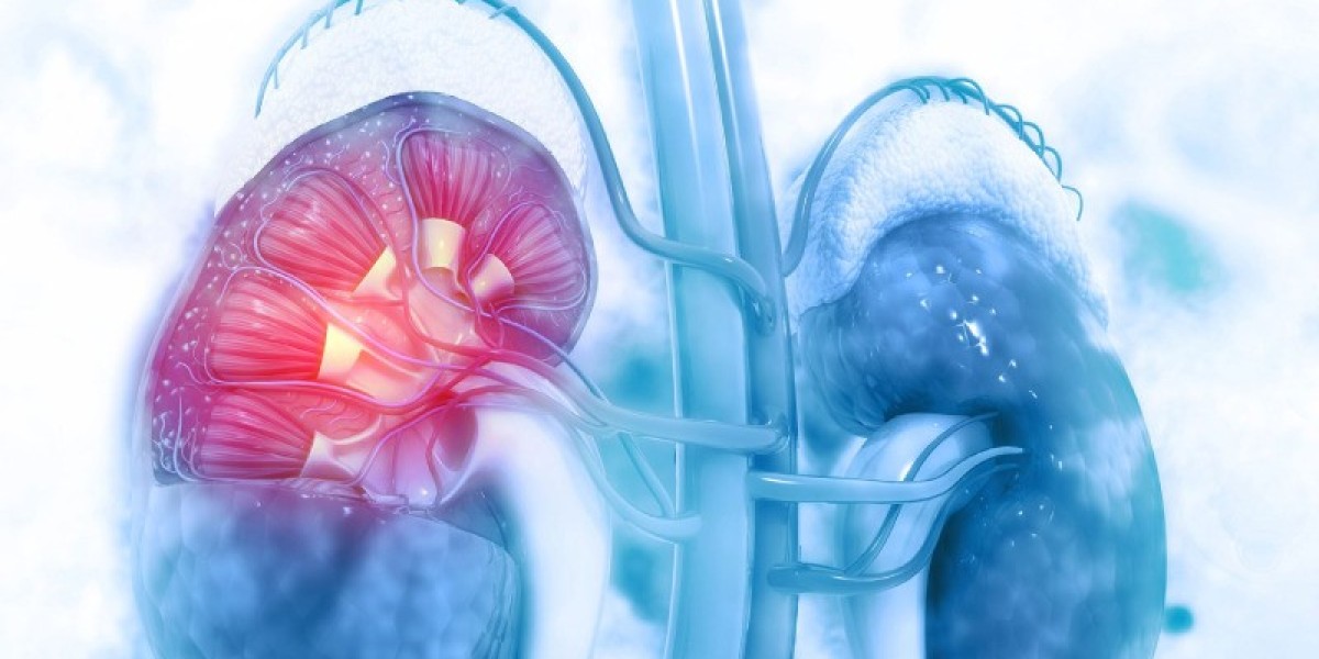 Acute Kidney Injury Market Research | 2023-2033