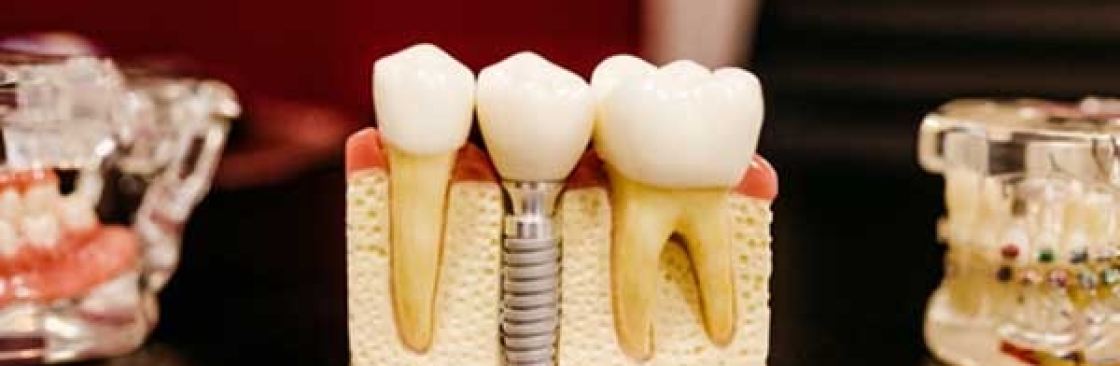 Dr Suryanarayanan Dental Clinic