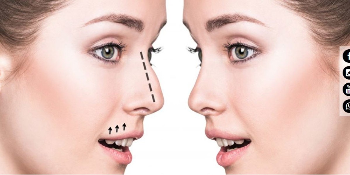 Rhinoplasty Surgery in Delhi