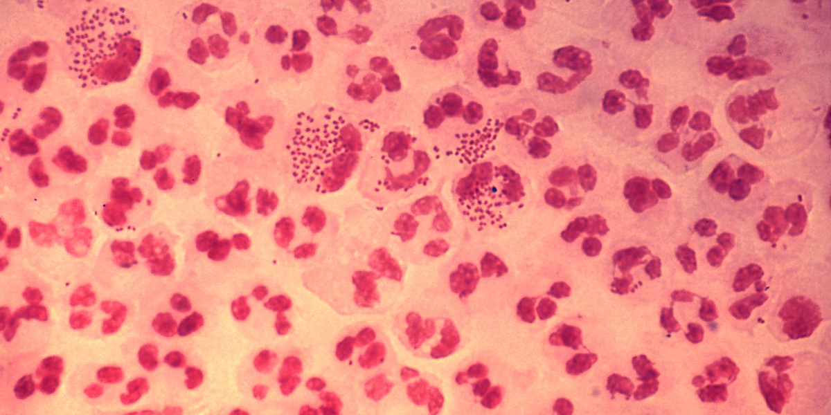 Gonorrhea Market Size 2023 | Forecast till 2033