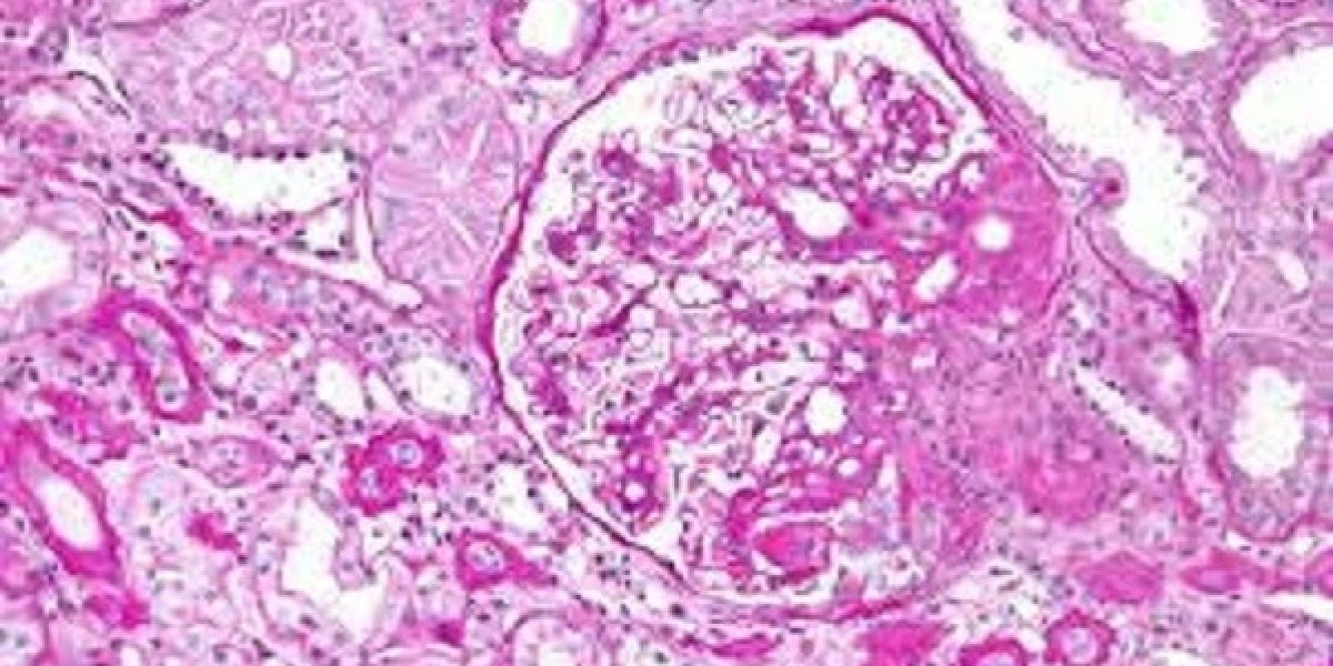 Focal Segmental Glomerulosclerosis Market Analysis, Epidemiology, Trends and Forecast till (2023-2033)