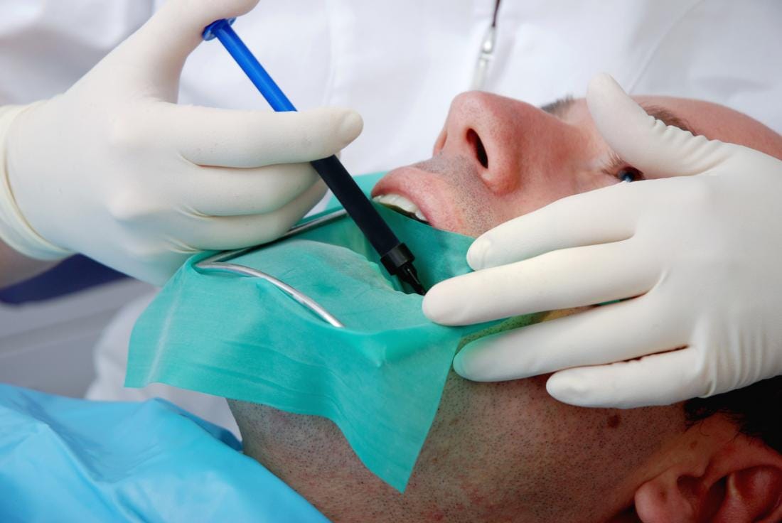 Is Root Canal Treatment Painful? Debunking the Misconceptions | by Smile Delhi - The Dental Clinic | Feb, 2024 | Medium