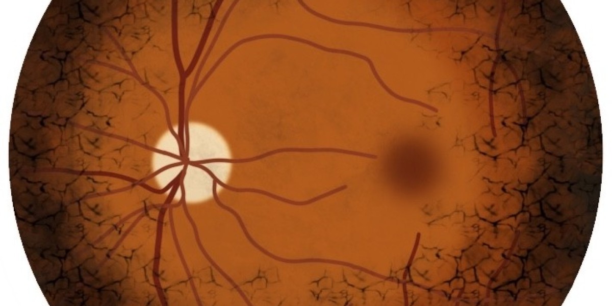 Retinitis Pigmentosa Market Companies, Market Trends & Analysis till 2034