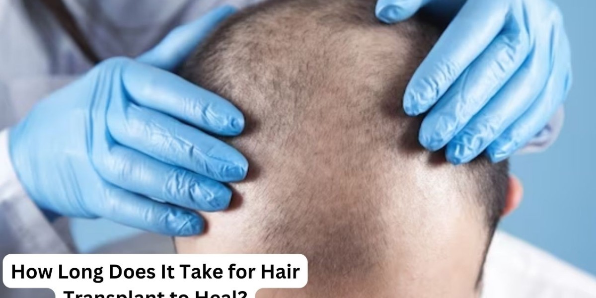 How Long Does It Take for Hair Transplant to Heal?