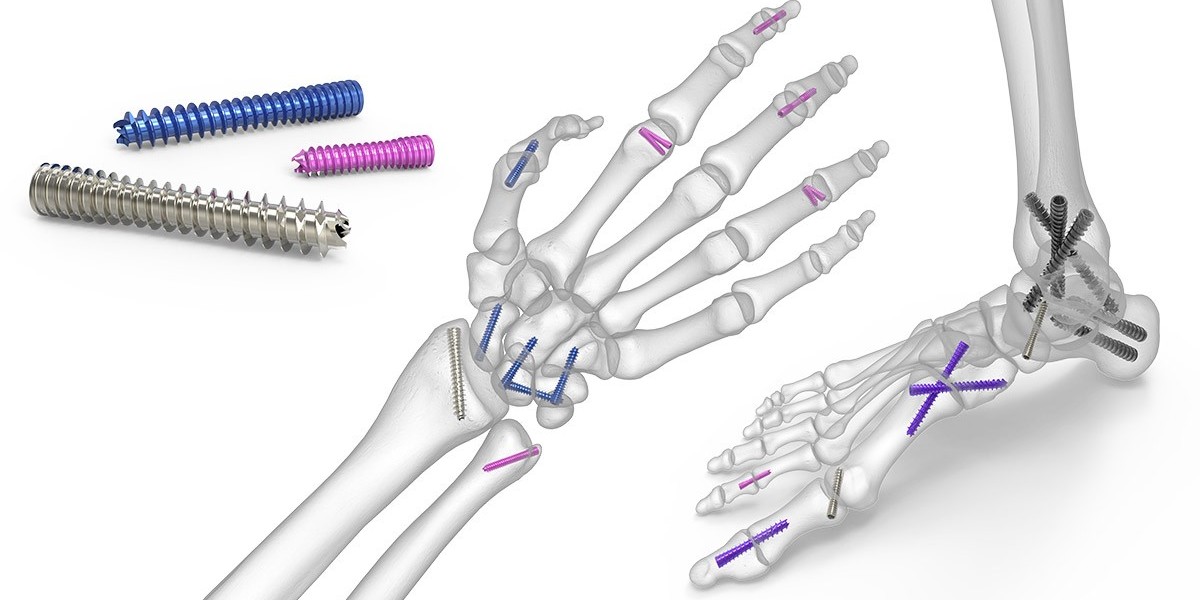 Stability Redefined: The Evolution of Orthopedic Fixation Devices