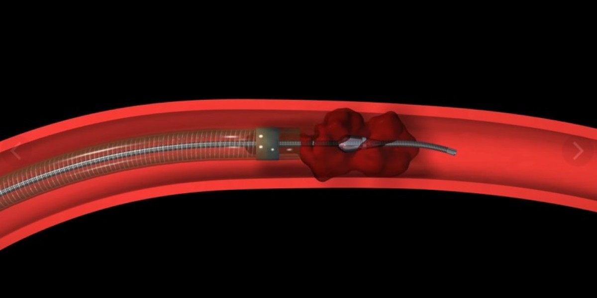 Thrombectomy Devices Market Key Vendors Analysis, Import & Export, Revenue Forecast 2030