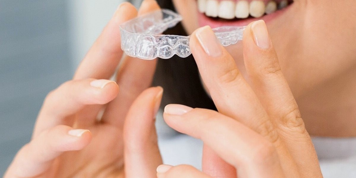 Invisalign: Revolutionising Orthodontic Treatment