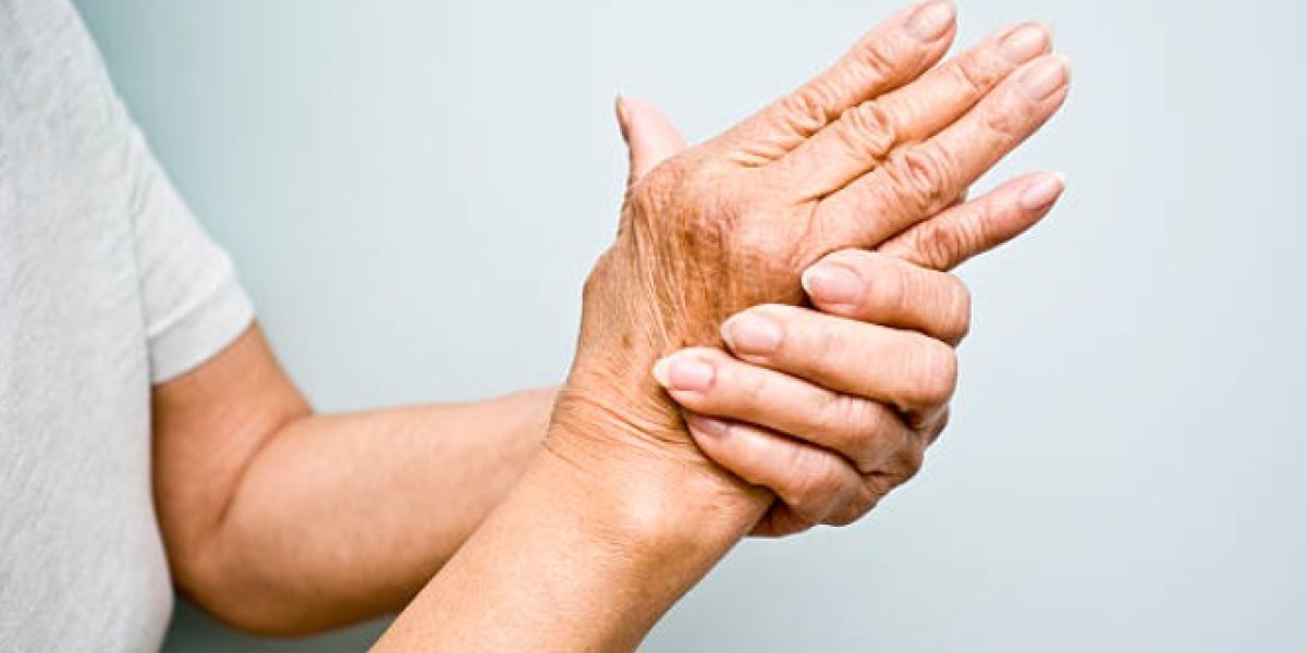 Understanding the 4 Stages of Rheumatoid Arthritis