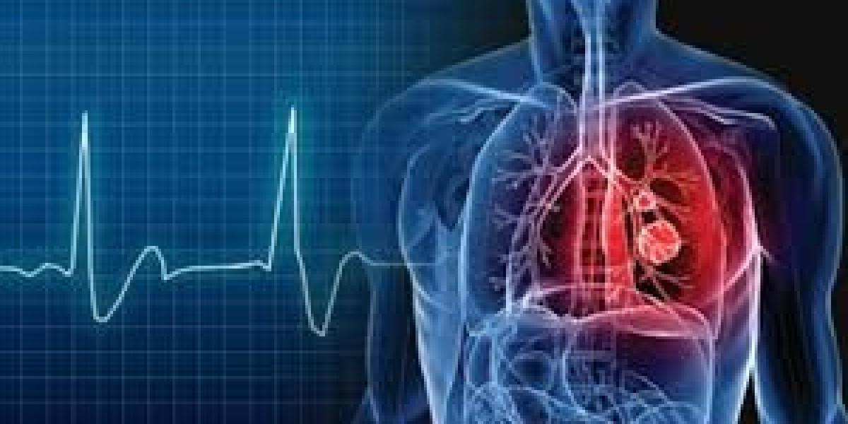 Electrophysiology Test Cost in Chennai: A Breakdown