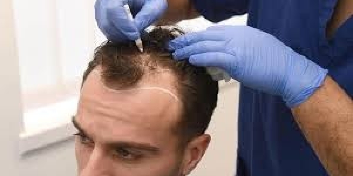 The Top Ten Causes of Male Hair Loss