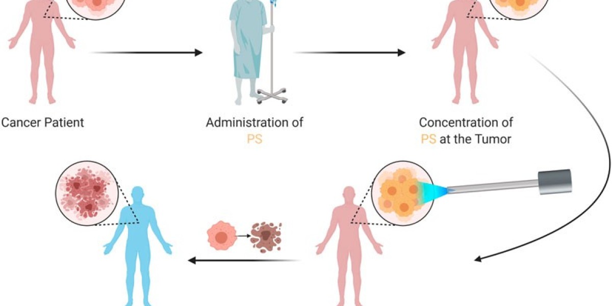 DUSA Pharmaceuticals and the Future of Multi-Wavelength Light Sources in Cancer PDT