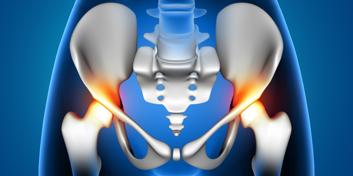 Global Hip Replacement Market Trends and Forecast 2023-2033