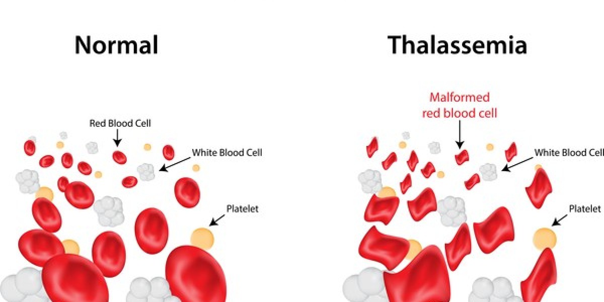 2024 Thalassemia Market | Report By 2034