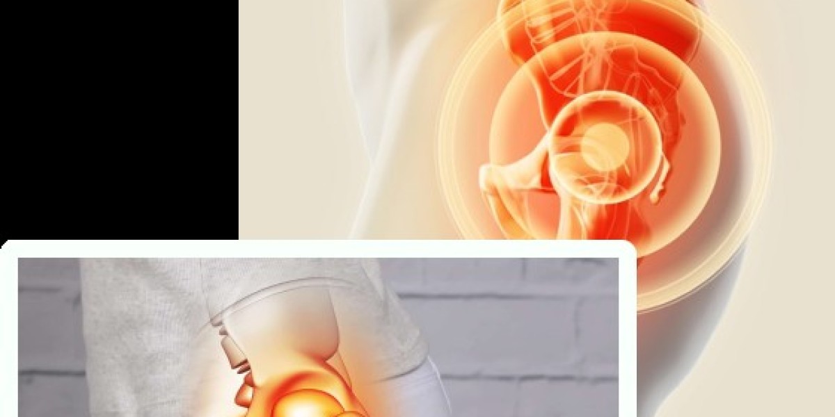 Choosing Orthocenter.PK for Hip Replacement Surgery in Lahore