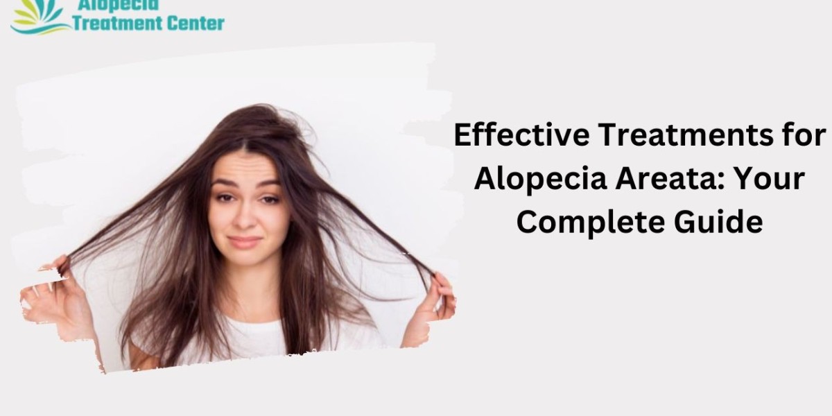 Effective Treatments for Alopecia Areata: Your Complete Guide