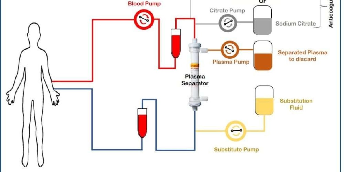 Plasmapheresis Market 2024 Competitive Insights and Precise Outlook | Skyquest