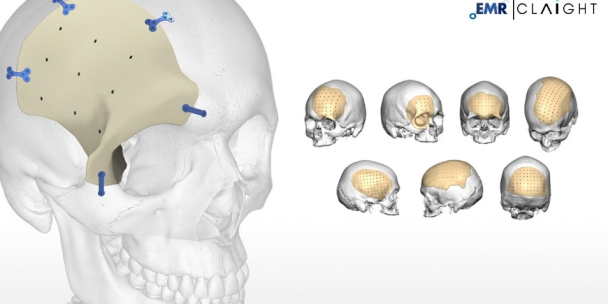 Global Cranial Implants Market