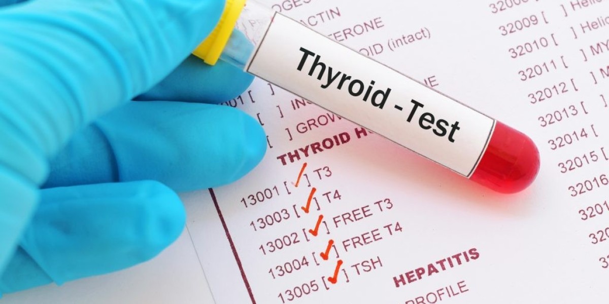 Thyroid Function Test Market Demand: The Role of Diagnostics in Healthcare and Patient Care