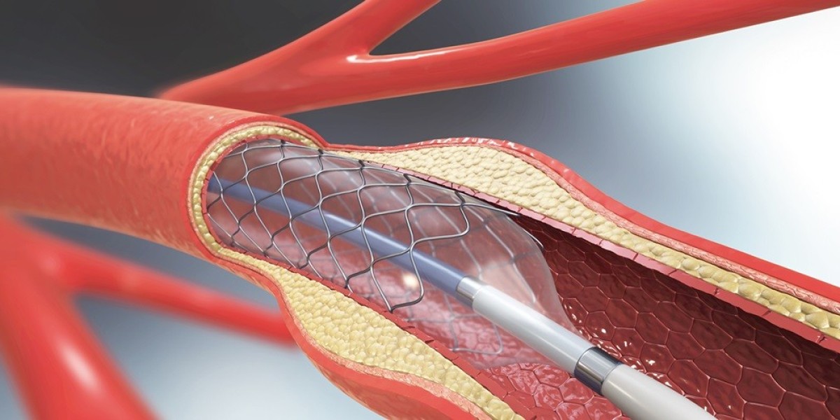 Angioplasty Balloons Market: How Advancements in Balloon Catheter Technology are Redefining Cardiac Interventions