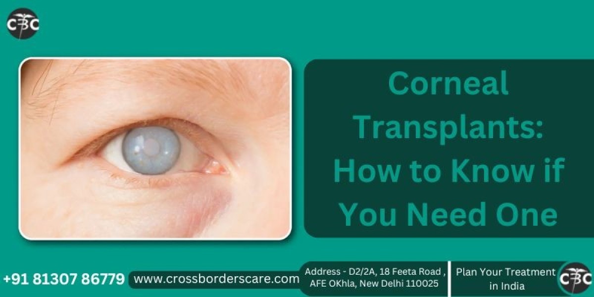 Corneal Transplants: How to Know if You Need One