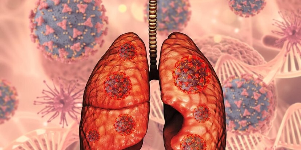 Global NSCLC Market Size, Share, Analysis and Forecast 2021 – 2030