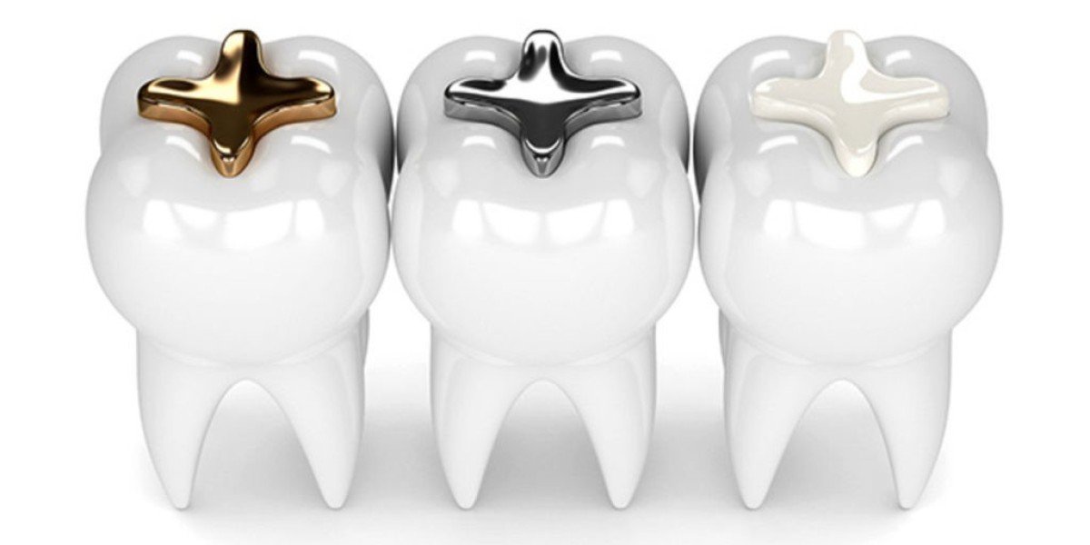 Tooth Filling Materials Market Trends: Navigating the Shift Towards Biocompatible and Eco-Friendly Options