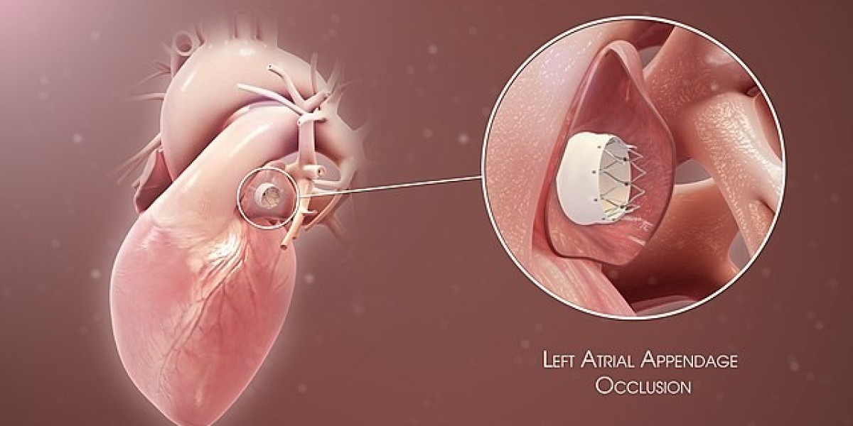 Atrial Fibrillation Devices Market: The Shift Toward Personalized and Remote Care