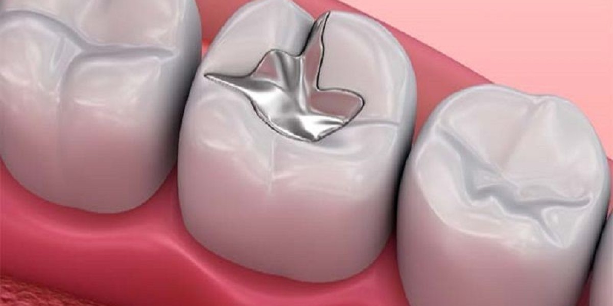 Tooth Filling Materials Market Scenario: A Deep Dive into Market Trends, Opportunities, and Challenges