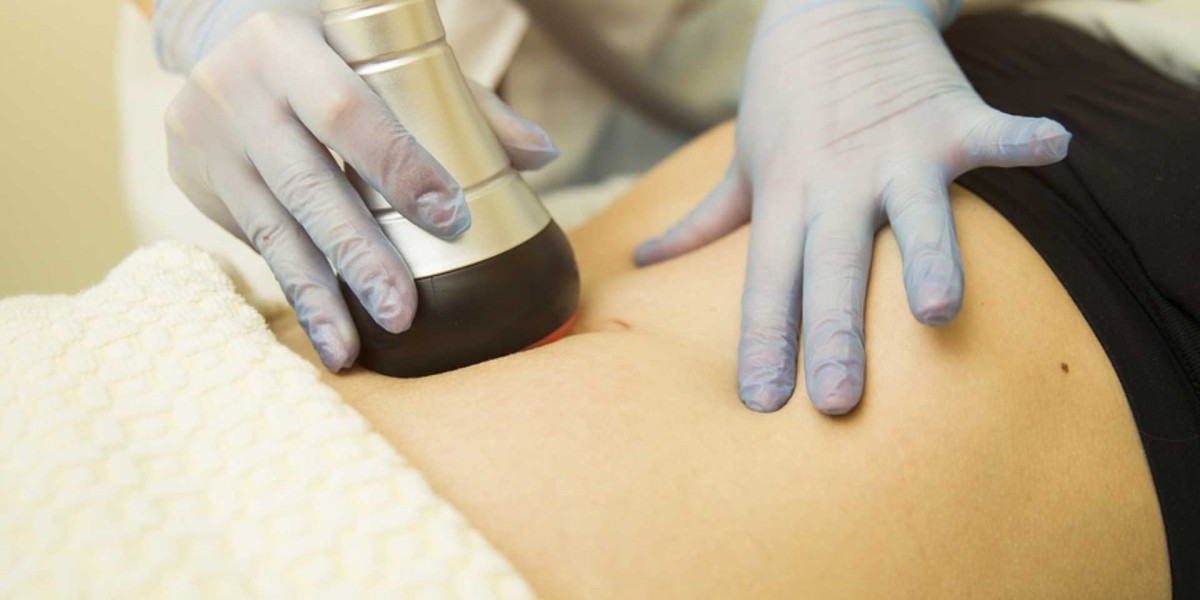 Laser Hair Removal in Delhi: Smooth, Hairless Skin, Stunning Results