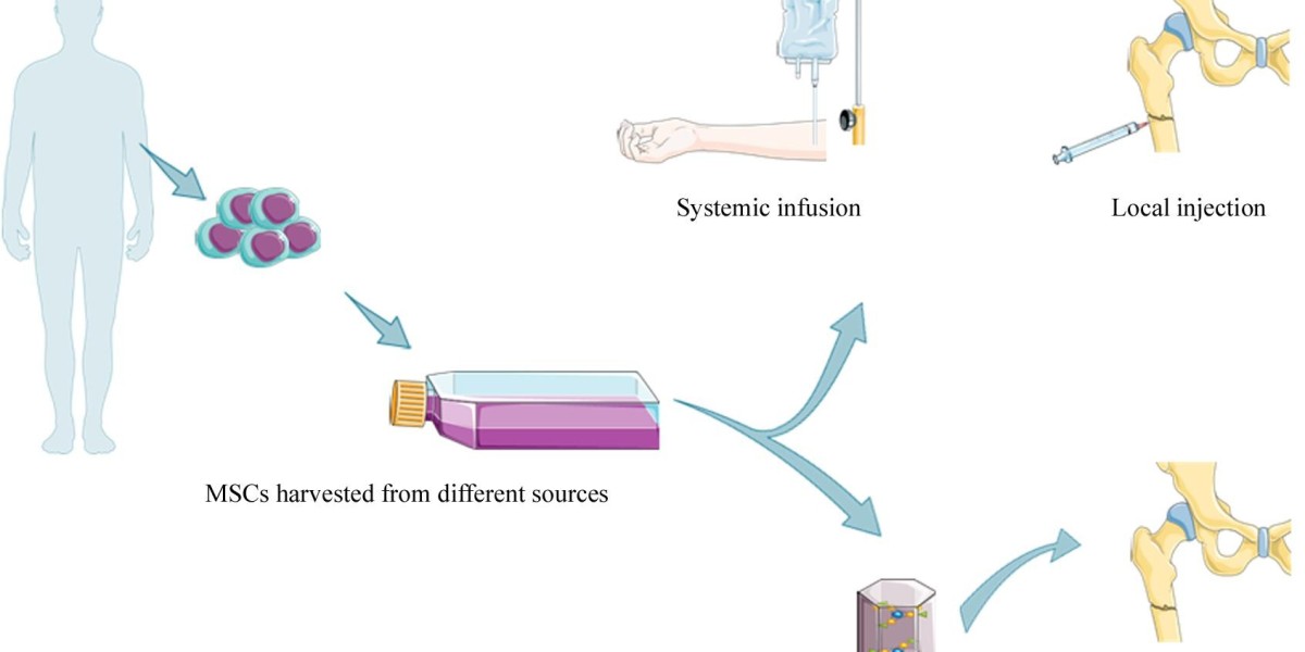 Bone Regeneration Market Developments: Innovations Shaping the Future