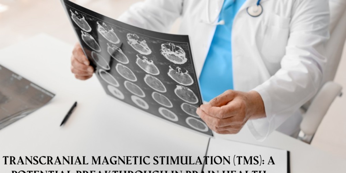 Transcranial Magnetic Stimulation (TMS): A Potential Breakthrough in Brain Health