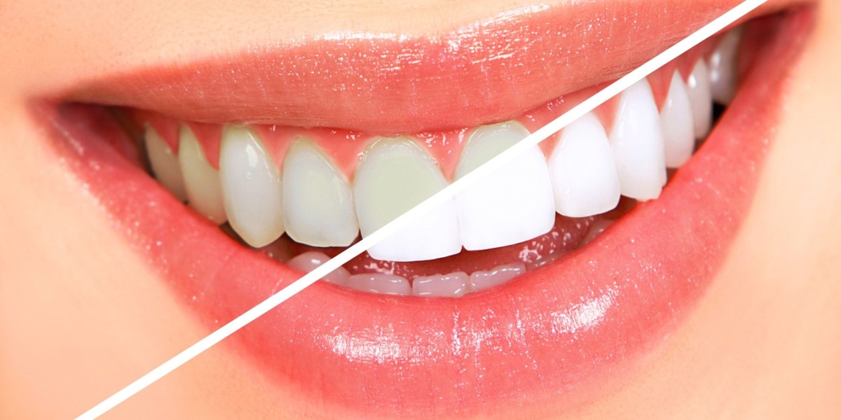 Crest White Strips